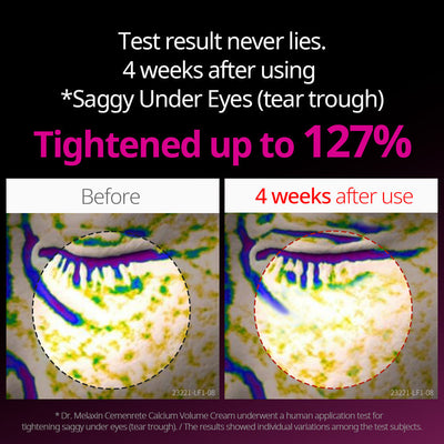 Cemenrete Eye care Line
